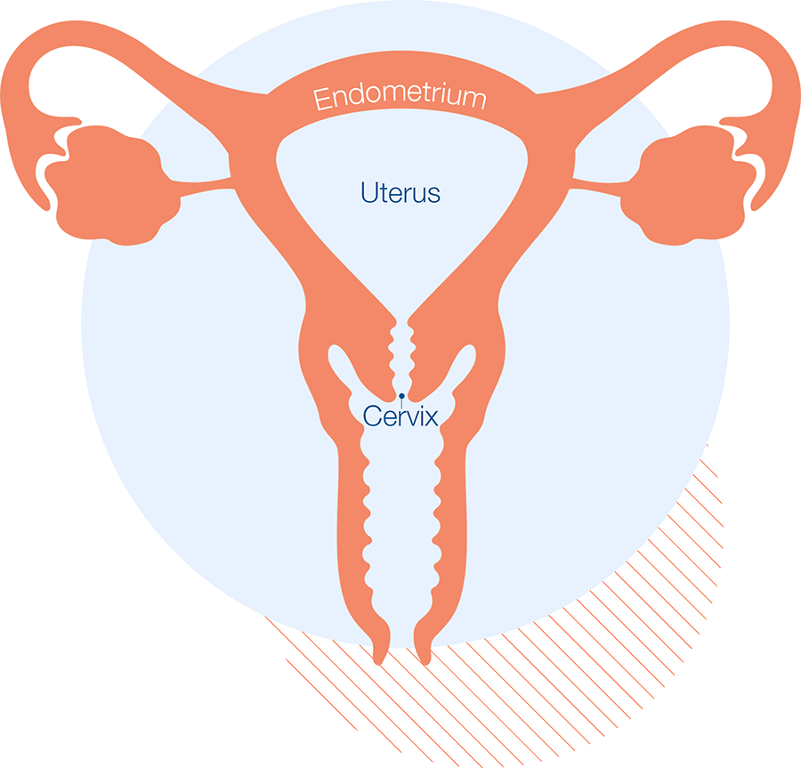 diagram of female reproductive system noting the endometrium, uterus, and cervix